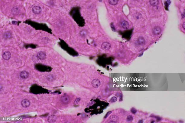 kupffer cells in liver sinusoids---these are phagocytic cells (black) that have ingested carbon (black particles), 250x - célula hepática fotografías e imágenes de stock