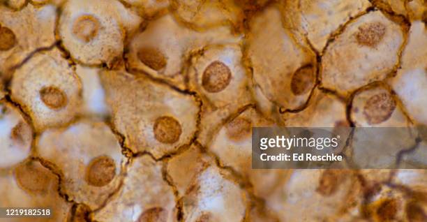 mesothelium---simple squamous epithelium lining the abdmoninal cavity, 250x - simple squamous epithelium stock-fotos und bilder