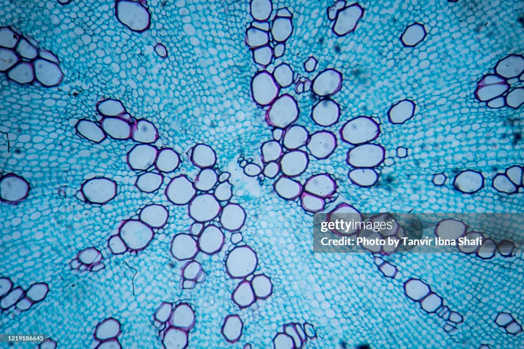 Microscopic image of carrot root