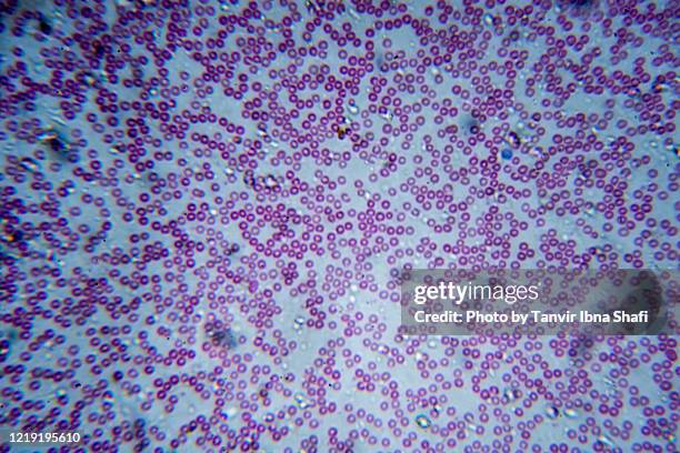 microscopic image of red and white blood cell - eosinófilo imagens e fotografias de stock