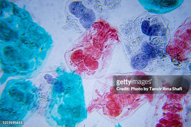 microscopic image of rotifera (cross-section) - süßwasser stock-fotos und bilder