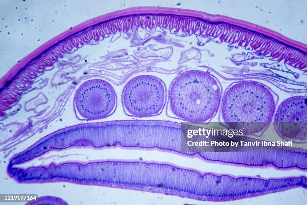 microscopic image of ascarid (cross section) - roundworm stock-fotos und bilder