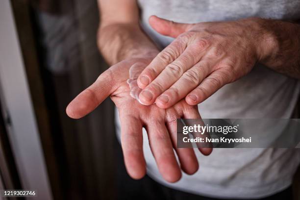 man putting moisturizer onto his hand with very dry skin and deep cracks with cream due to washing alcohol on covid19 situation. horizontal close up of the inside of a very sore dry cracked male hand - dry stockfoto's en -beelden