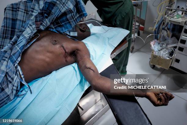 Patient with a gunshot wound lies down on a stretcher before being operated at the hospital of Mopti, on May 27, 2020. - In parallel with the...