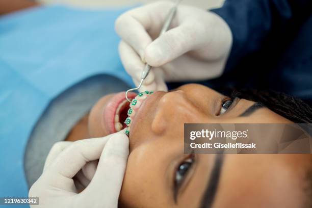 dentista poniendo aparatos dentales en una adolescente en una clínica dental clínica - orthodontics fotografías e imágenes de stock