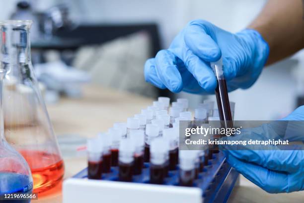 blood research,scientist hand holding test tube with blood in laboratory. - 血 個照片及圖片檔