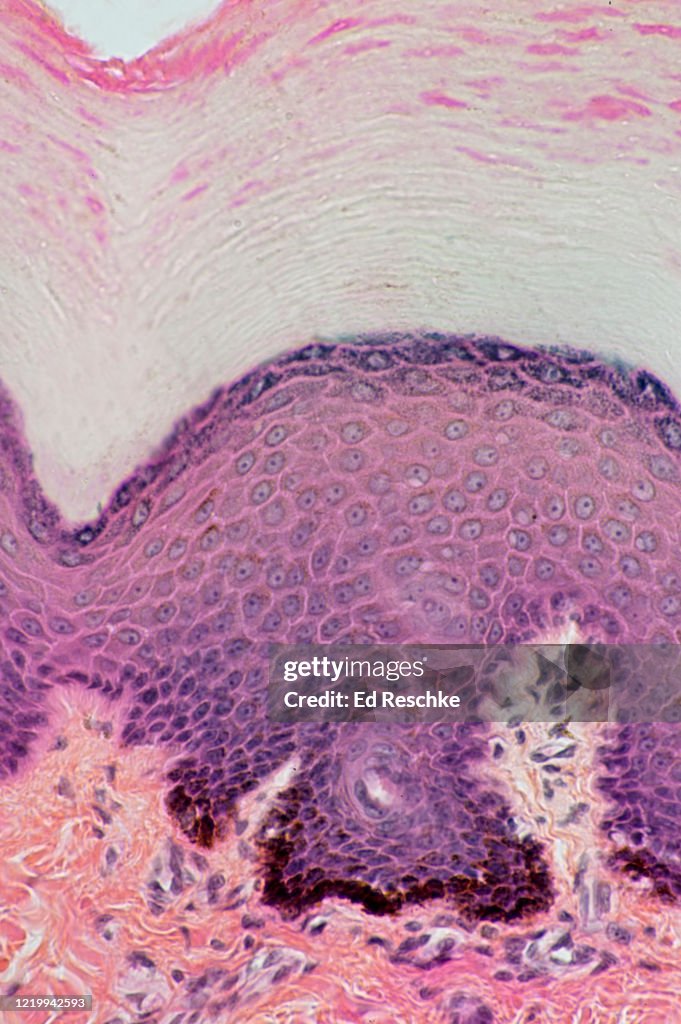 EPIDERMAL LAYERS and MELANOCYTES in the BASAL LAYER, Human Skin, Keratinized, 100X