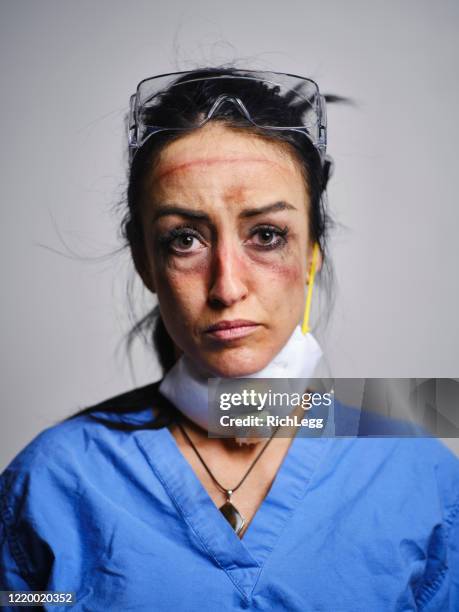 fatigued healthcare worker - injured woman stock pictures, royalty-free photos & images