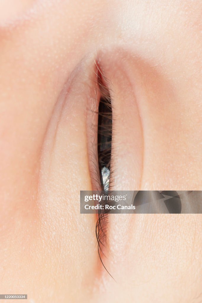 Closed Eye