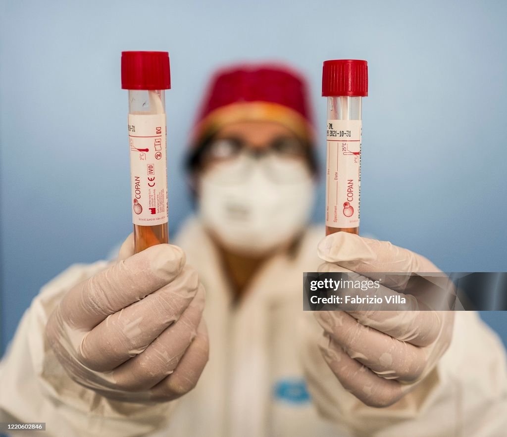 Italy Coronavirus Cases Slightly Drop After Weeks Of Lockdown