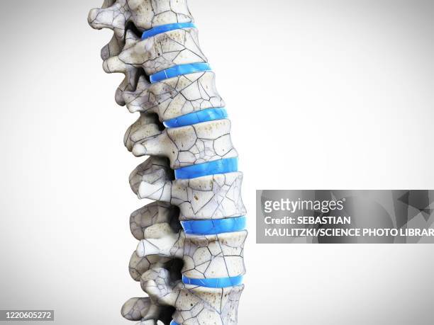 ilustrações, clipart, desenhos animados e ícones de broken spine, illustration - osteoporose