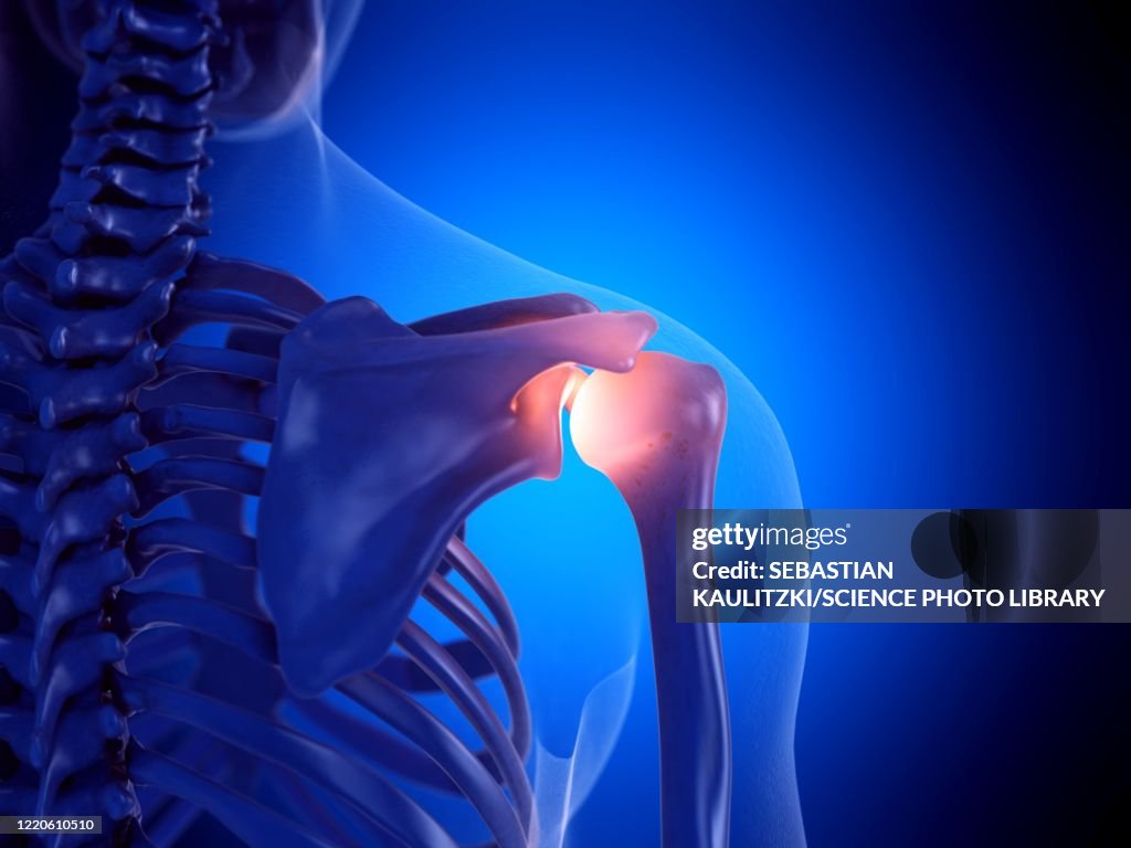 Painful shoulder joint, illustration