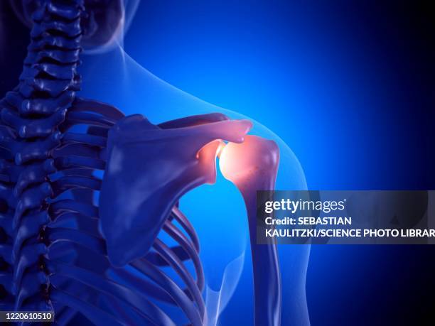 painful shoulder joint, illustration - shoulder bone stock illustrations