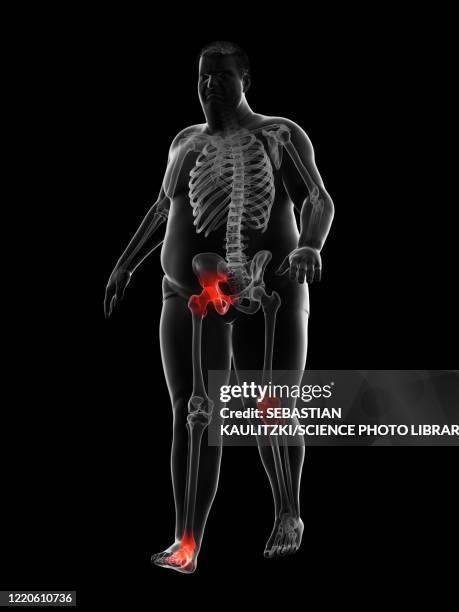 obese runner's painful joints, illustration - meniscus stock illustrations