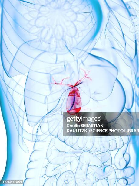 diseased gallbladder, illustration - bladder pain stock illustrations