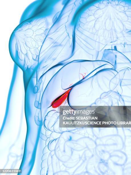 diseased gallbladder, illustration - bladder pain stock illustrations