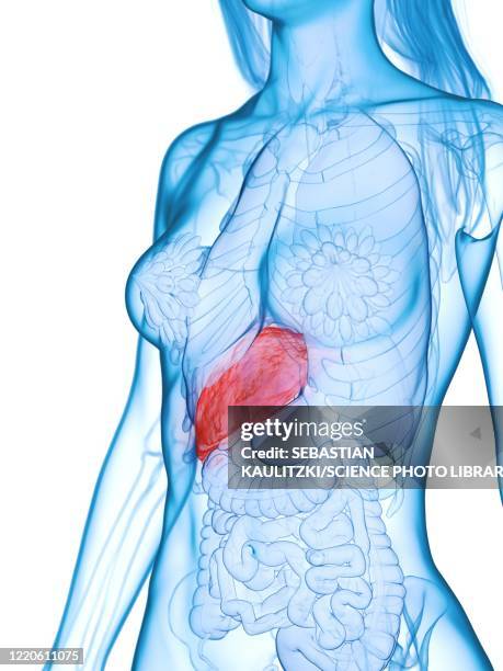 diseased liver, illustration - cirrhosis 幅插畫檔、美工圖案、卡通及圖標