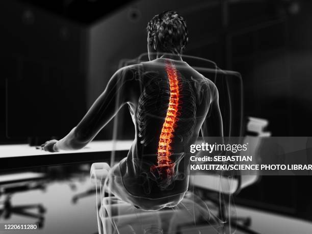 man with backache, illustration - human vertebra 幅插畫檔、美工圖案、卡通及圖標
