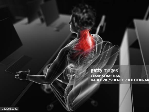 muscle pain, illustration - neck muscle pain illustration stock illustrations