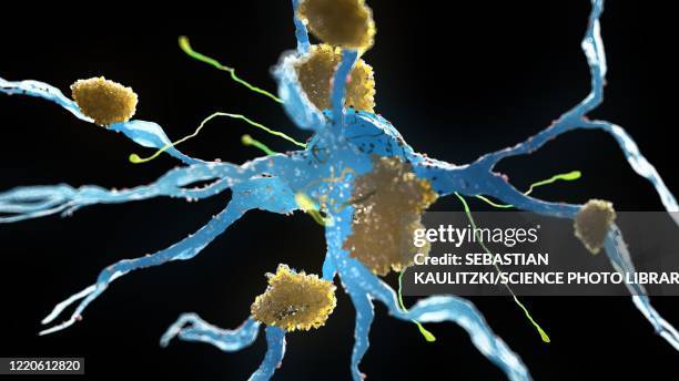 alzheimer's nerve cells, illustration - amyloidosis stock illustrations