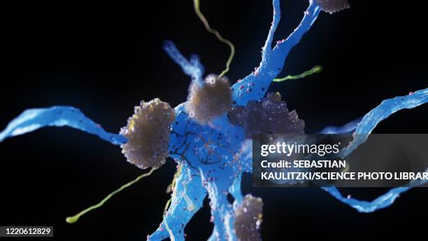alzheimer's nerve cells, illustration - alzheimers brain stock illustrations