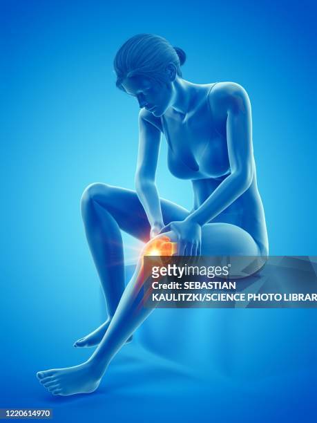 woman with a painful knee, illustration - rheumatism 幅插畫檔、美工圖案、卡通及圖標