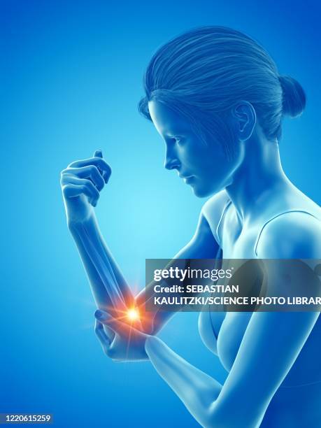 woman with a painful elbow, illustration - osteoporosis bone stock illustrations