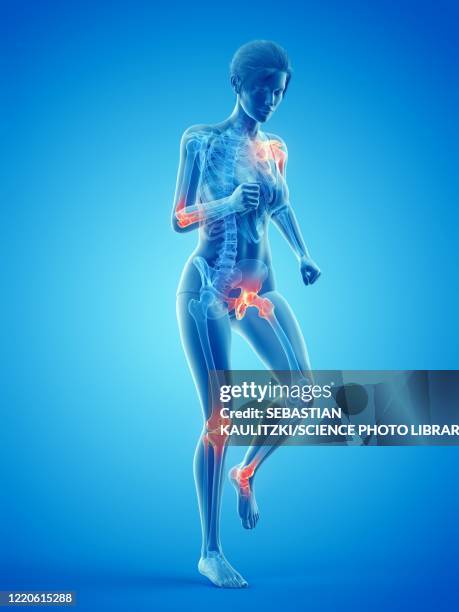 woman with painful joints while walking, illustration - chronic illness stock illustrations