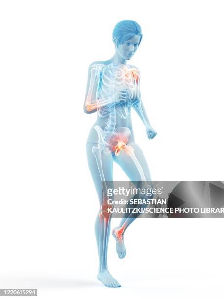 woman with painful joints while walking, illustration - osteoporose stock-grafiken, -clipart, -cartoons und -symbole