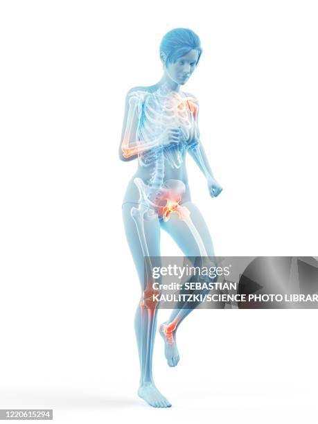 woman with painful joints while walking, illustration - osteoporosis stock illustrations