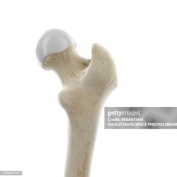 upper femur joint, illustration - hamstring stock illustrations