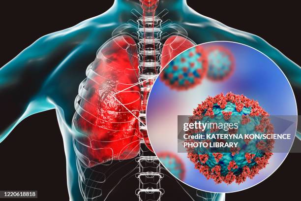 coronavirus disease of the lungs, conceptual illustration - rna stock-grafiken, -clipart, -cartoons und -symbole