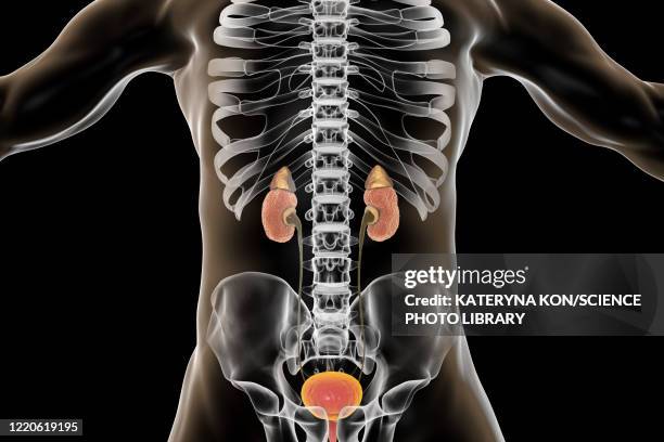 chronic kidney disease, illustration - cyst stock illustrations