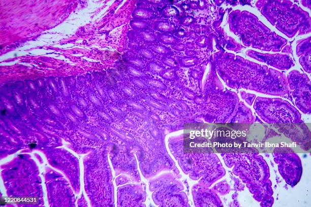 microscopic image of a small intestine (cross section) - biopsy stock pictures, royalty-free photos & images