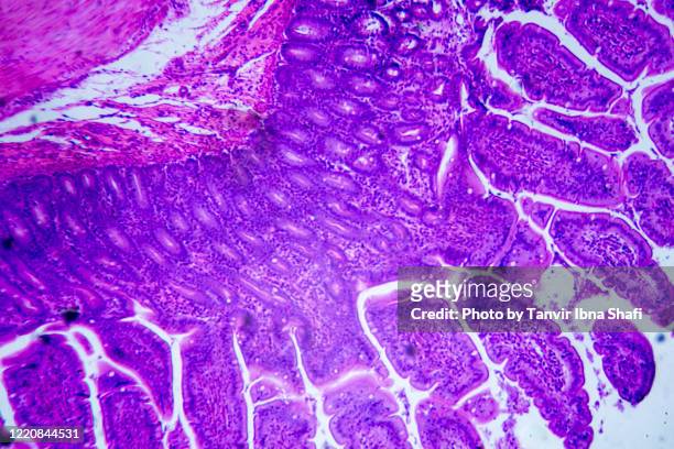 microscopic image of a small intestine (cross section) - cancer center bildbanksfoton och bilder