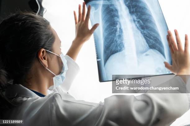 asian female doctors speculate on x-ray images from virus corona-infected lung patients. - lungenkrebs stock-fotos und bilder