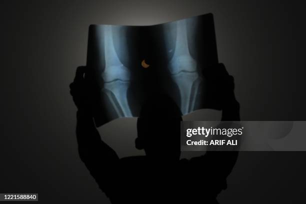 Man watches an annular solar eclipse through an X-Ray film in Lahore on June 21, 2020.