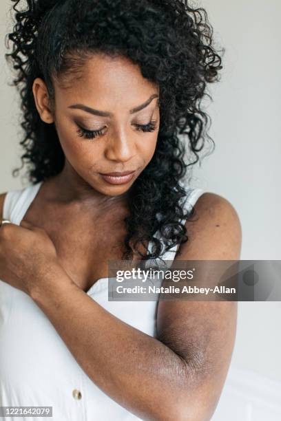 embracing my skin, my eczema - eczema stock pictures, royalty-free photos & images