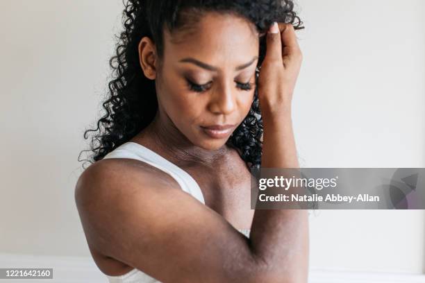 close-up of young woman, content and confident in her skin and managing her eczema - eczema stock pictures, royalty-free photos & images