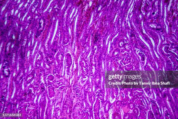 microscopic image of kidney cross section - brain cross section stock pictures, royalty-free photos & images