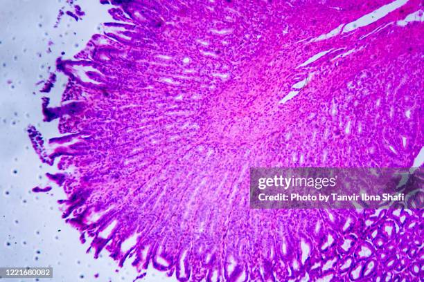 microscopic image of stomach wall cross section - slijmvlies colon stockfoto's en -beelden