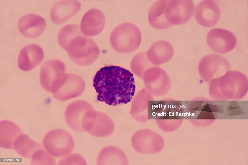 Basophils Rbc Basophil Histology WBC YOLO ViT: 2 Way 2 Stage White Blood Cell