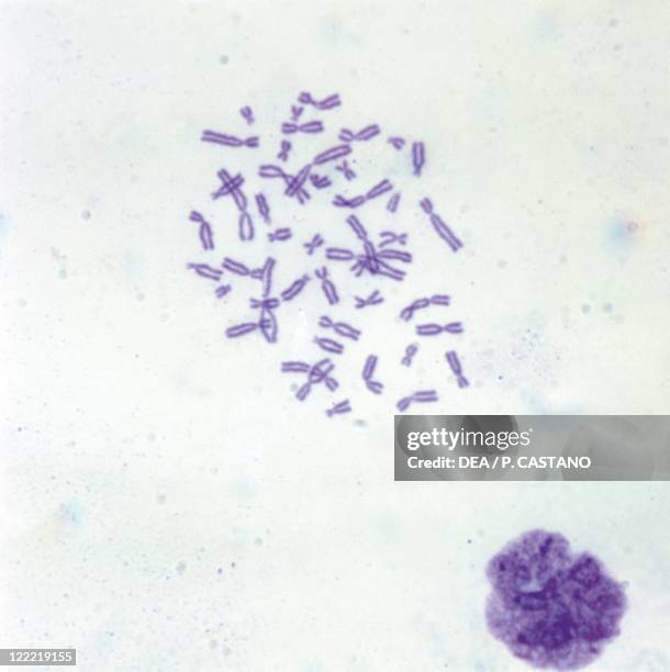 Biology - Genetics - Human chromosomes under a microscope.