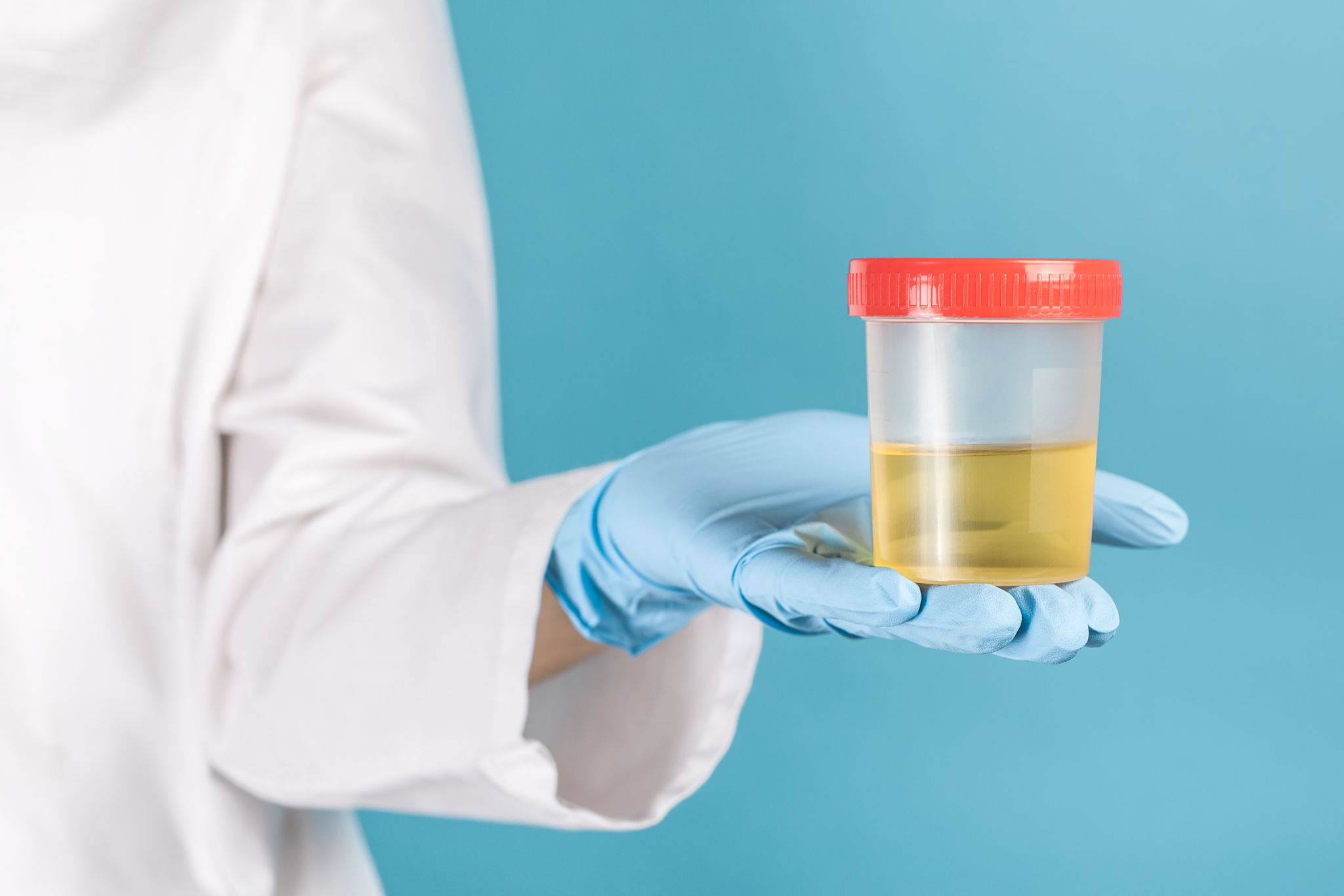 urine color chart