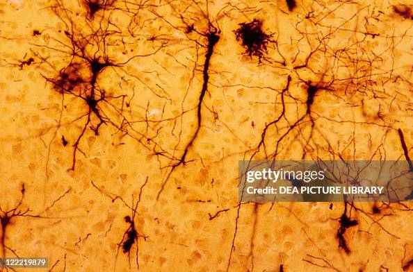 Pyramidal Cells Microscope Biology - Anatomy - Human Histology - Nervous tissue, pyramidal cells ...