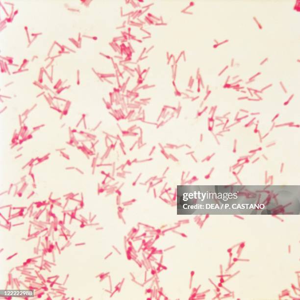 Biology - Medicine - Microbiology - Clostridium tetani, causative agent of tetanus under the microscope with contrast color.