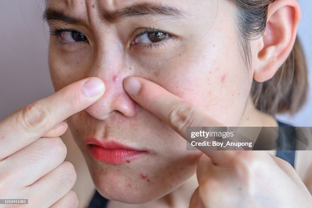 Pointing Problems Closeup Of Woman Pointing A Problem On Her Face With Variety Problems ...