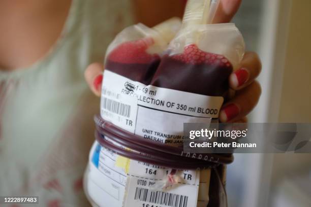 close-up bag of donated blood in asian woman's hand - blood bag stock pictures, royalty-free photos & images