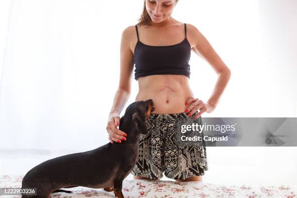 care dog licking his owner's scars - house of ogan stock pictures, royalty-free photos & images