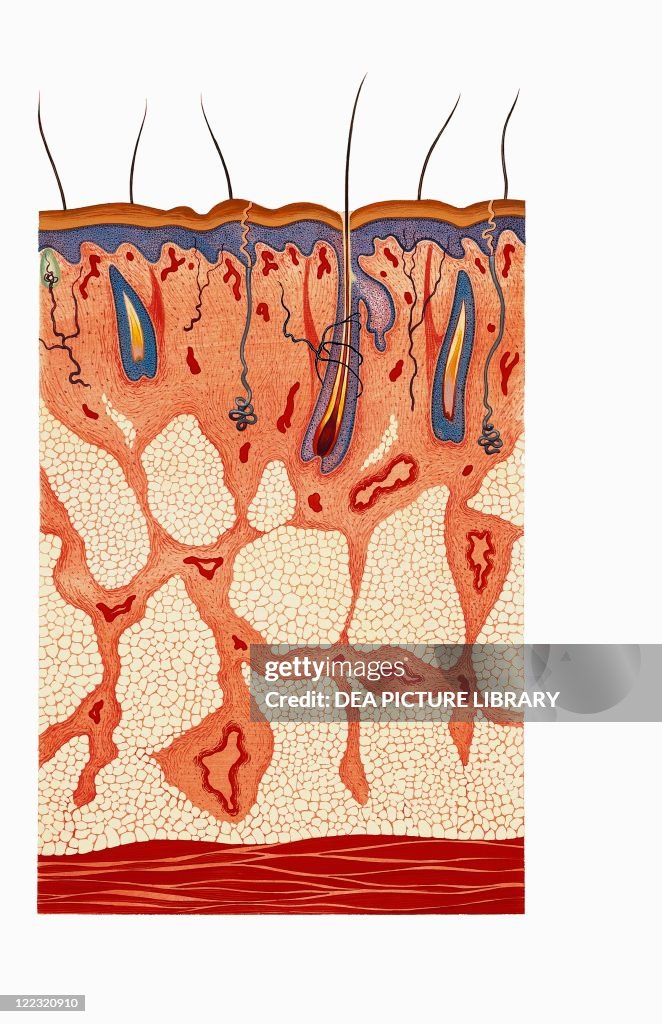 Favus Rash Medicine - Pathology - Scalp affected by dermal mycosis: favus or ...